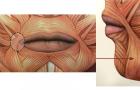 Уменьшение носогубной складки и морщин около углов рта: упражнение для мышцы, поднимающей угол рта Мышца поднимающая угол рта синергисты